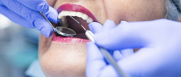 Best Emergency Root Canal Treatment in New Port Richey East, FL